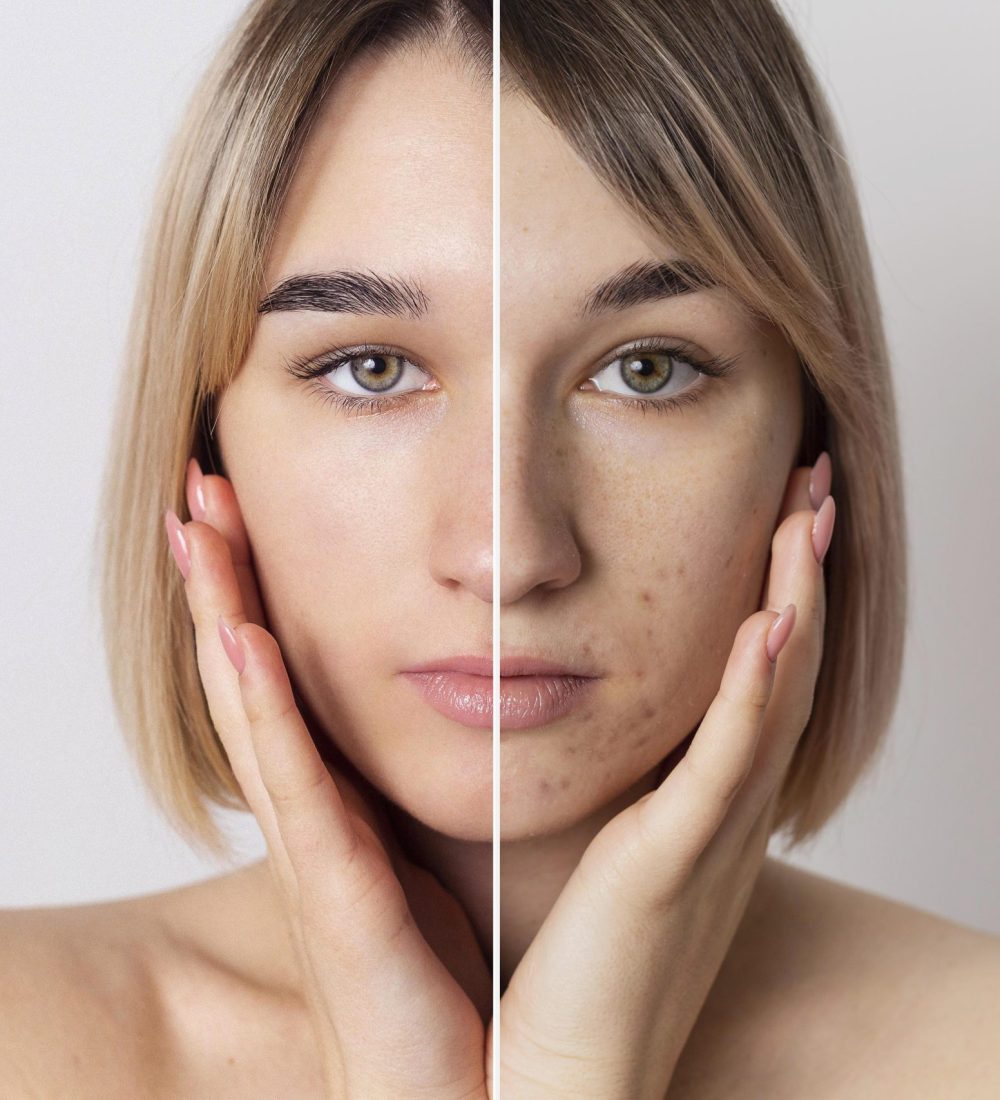 before-after-portrait-woman-retouched(3)